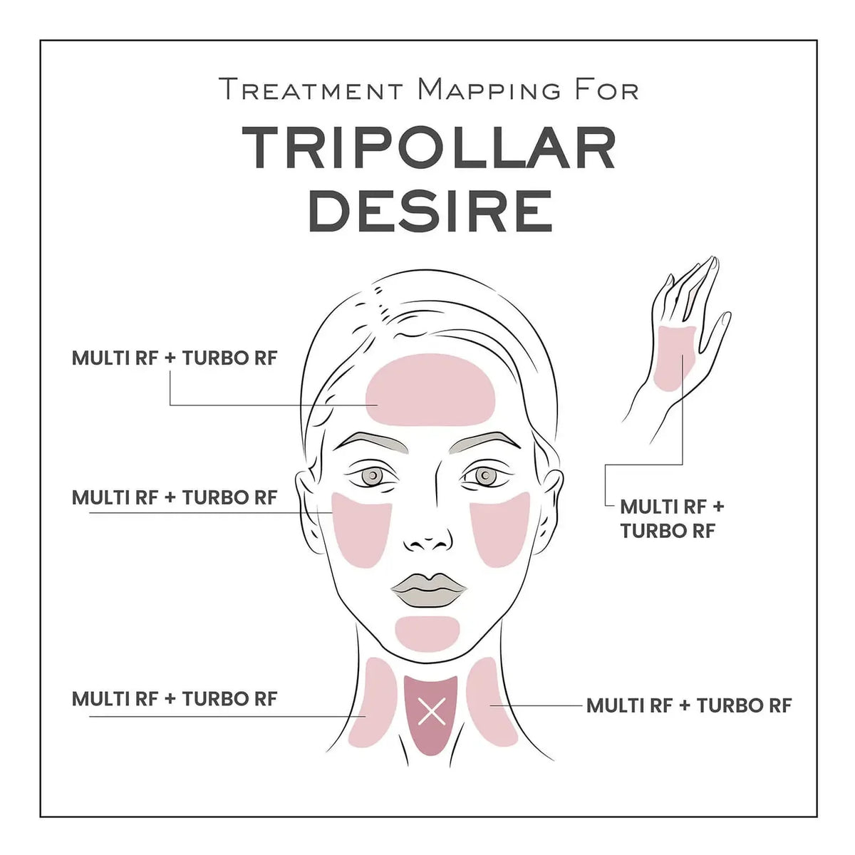 TriPollar Desire Facial Renewal & Rejuvenation Device (Copy) Tripollar
