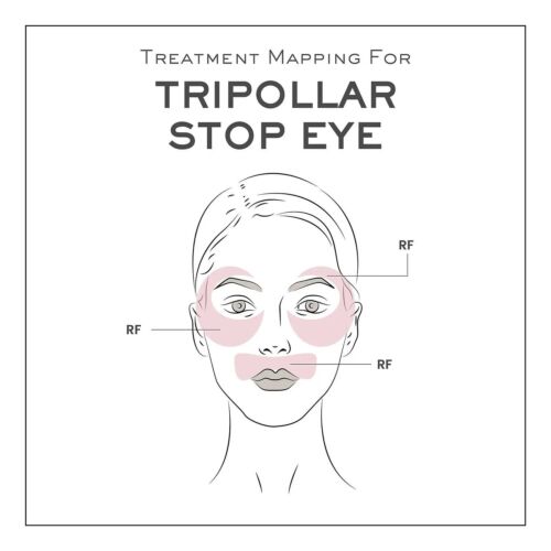Tripollar Stop Eye High Frequency RF Facial Machine For Daily Skincare ...
